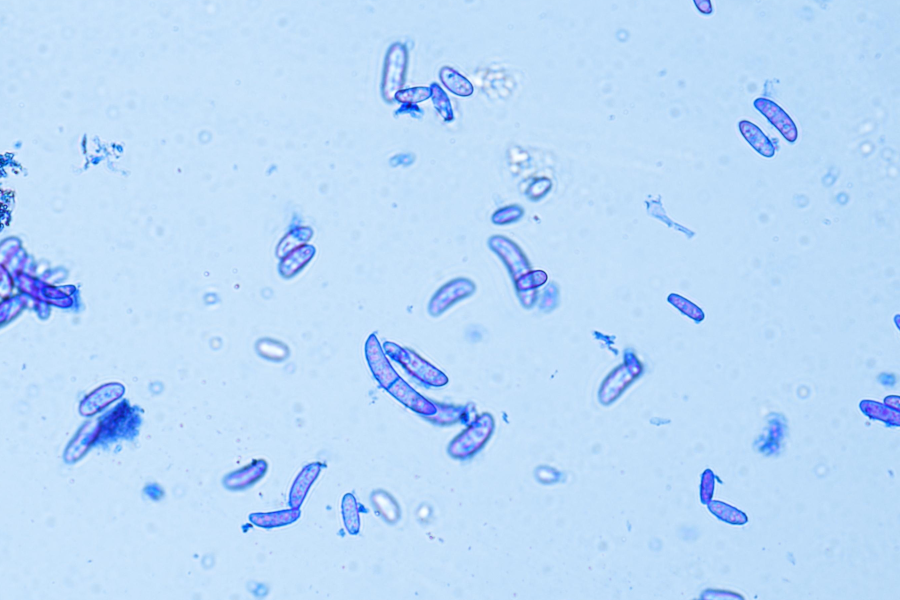 A blue-stained microscopic image showing many small oval-shaped cells scattered against a light background.
