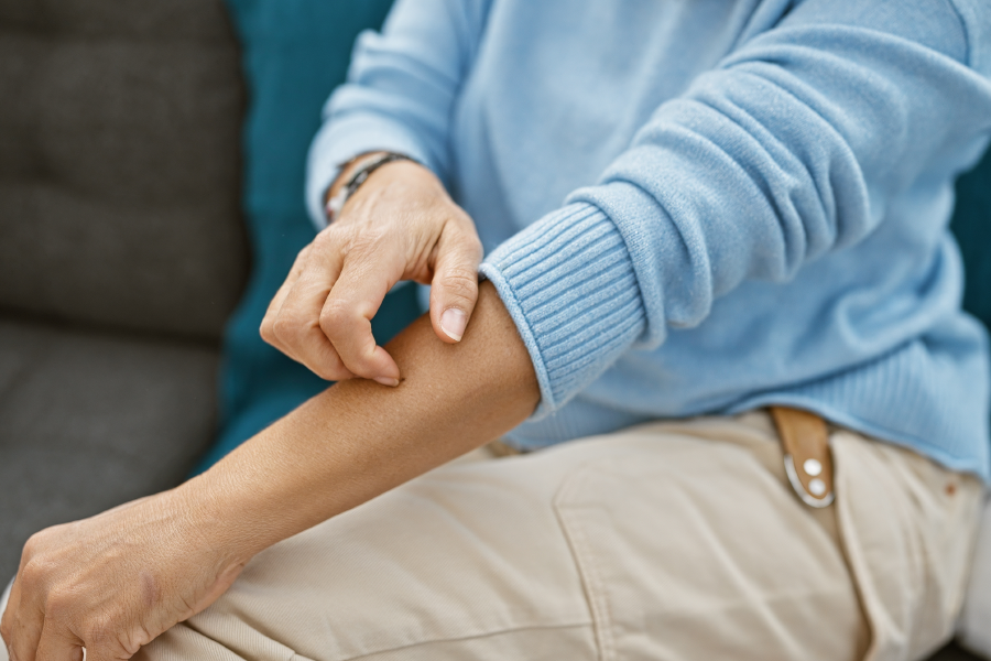 A person scratching their arm due to an allergic reaction.